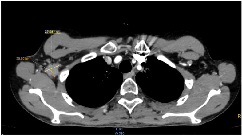 Figure 1