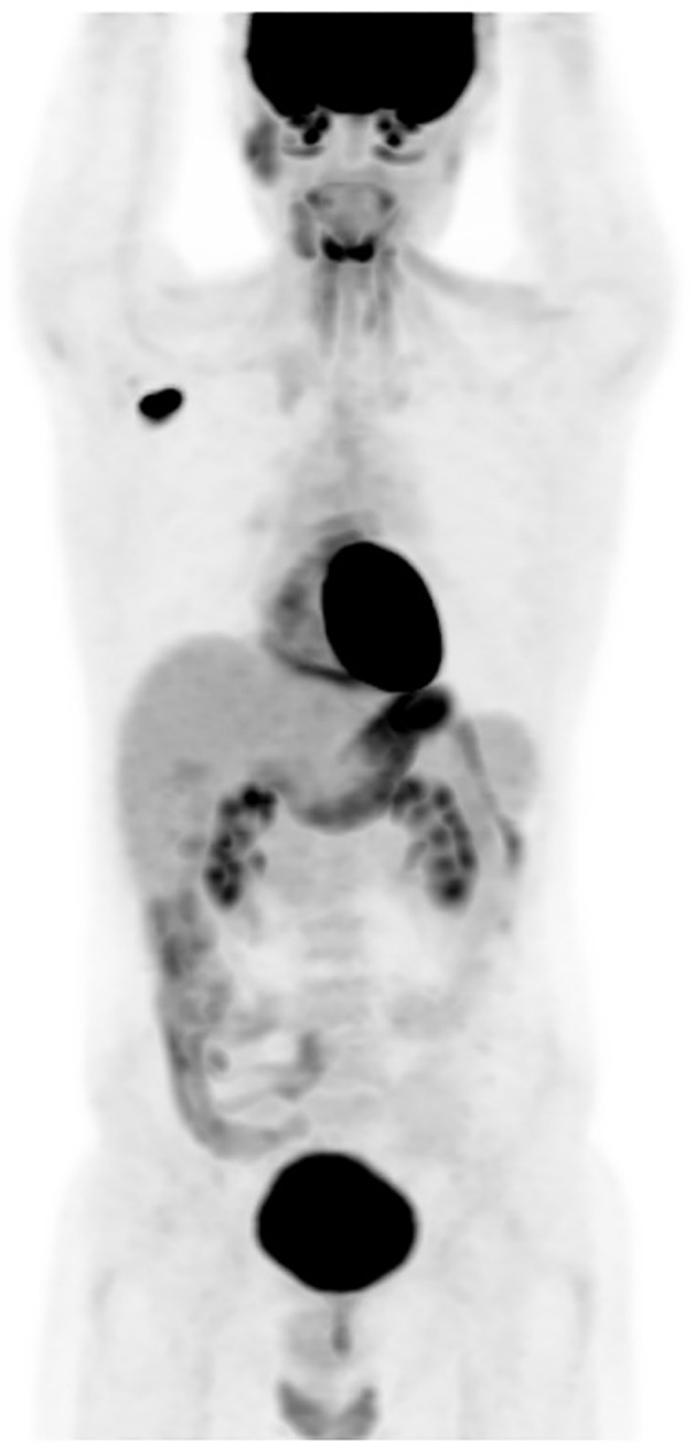 Figure 2