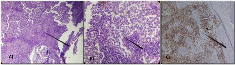 Figure 3