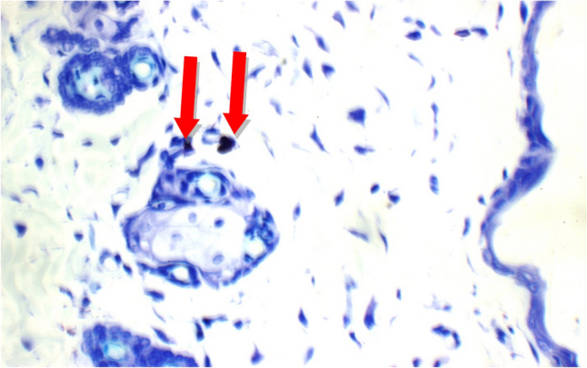 Figure 14