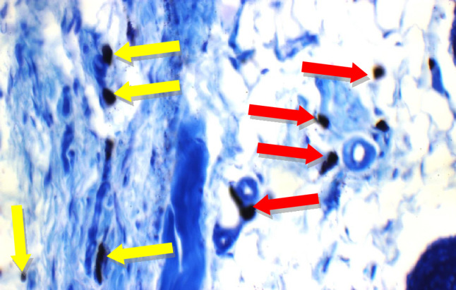 Figure 15