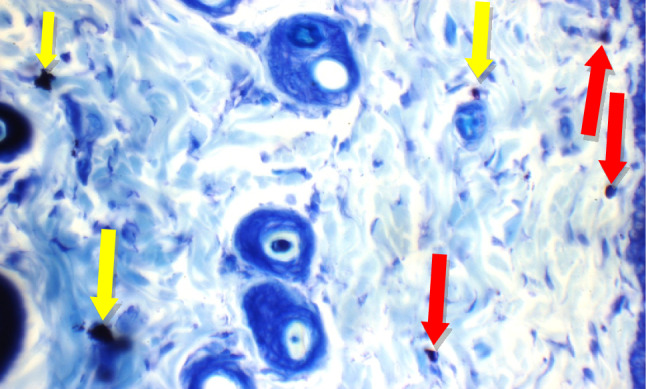 Figure 16