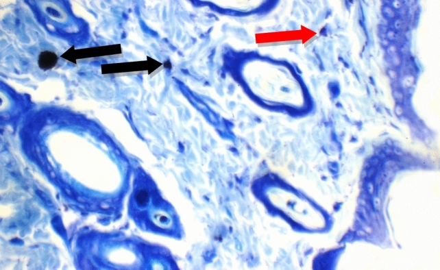 Figure 17