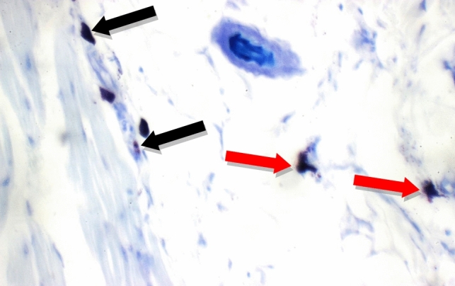 Figure 18