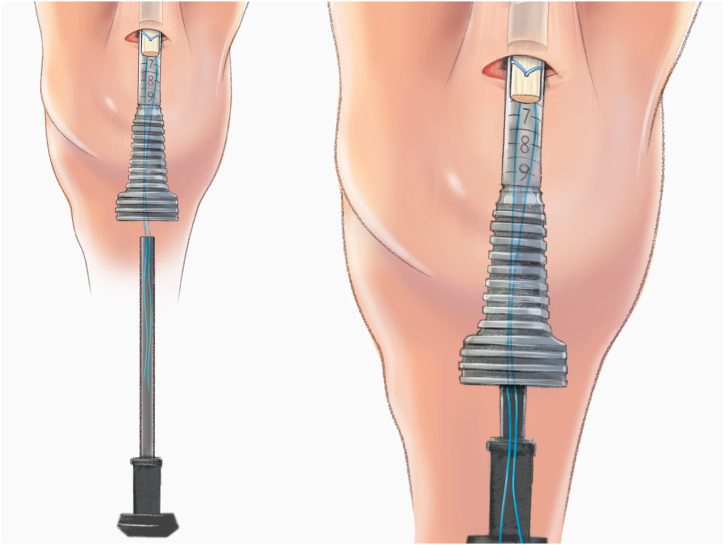 Figure 15