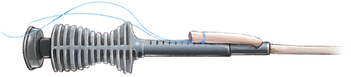 Figure 16