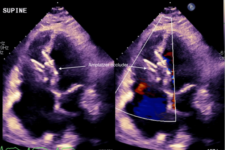 Figure 5