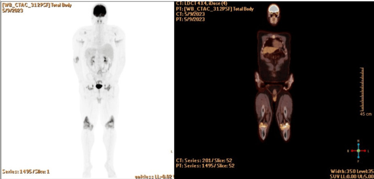 Figure 10