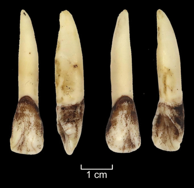 Figure 13