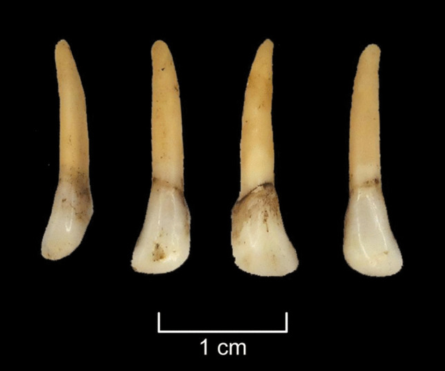 Figure 17