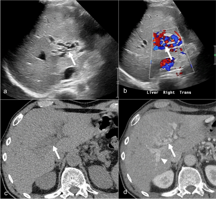 Figure 12