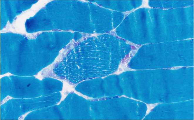 Figure 20