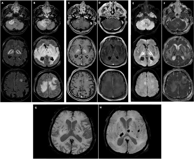 Figure 37