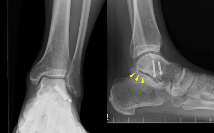 Figure 6