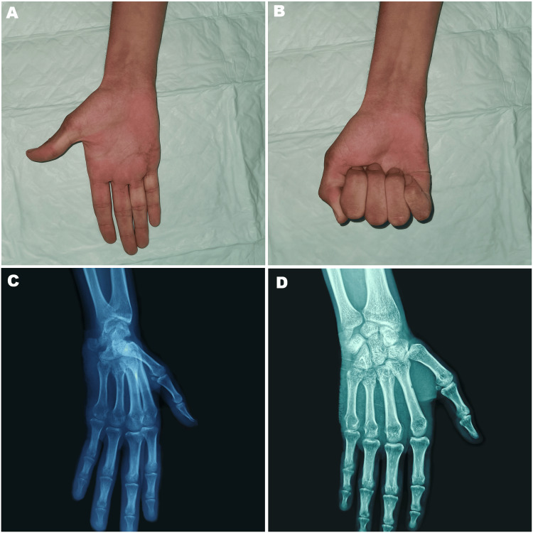 Figure 5