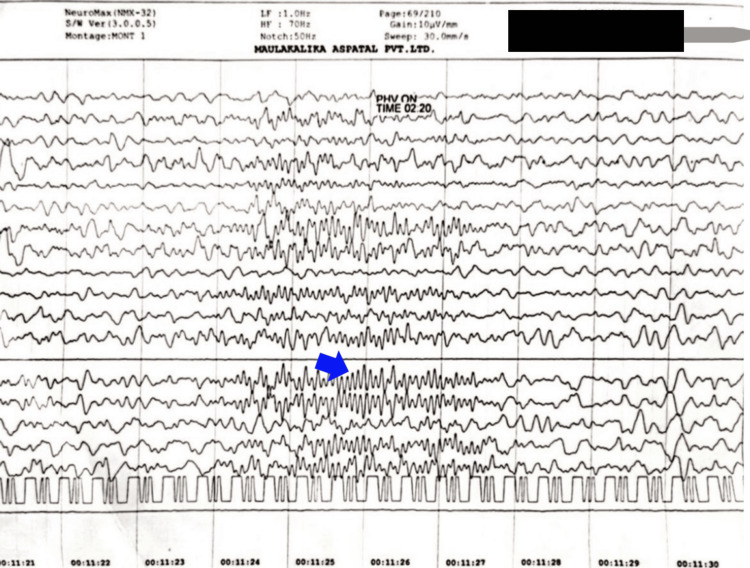 Figure 2