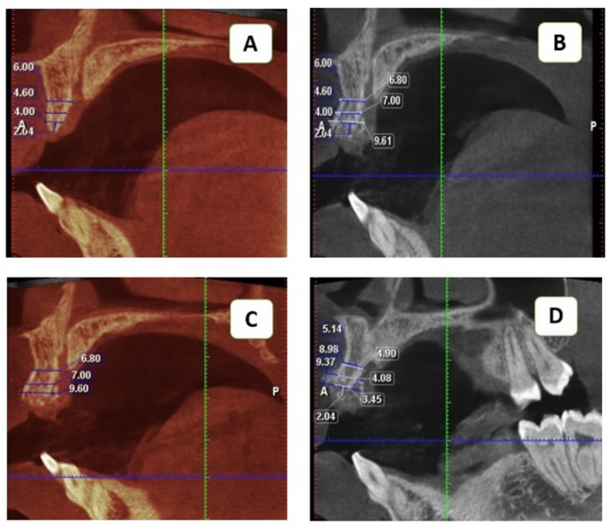 Figure 11
