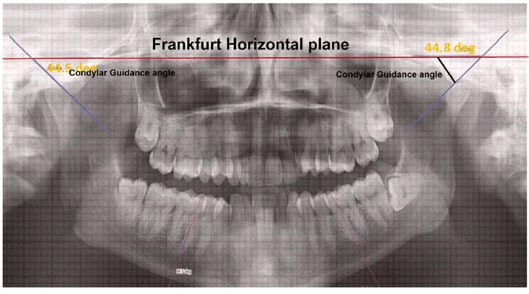 Figure 5