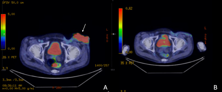 Figure 5