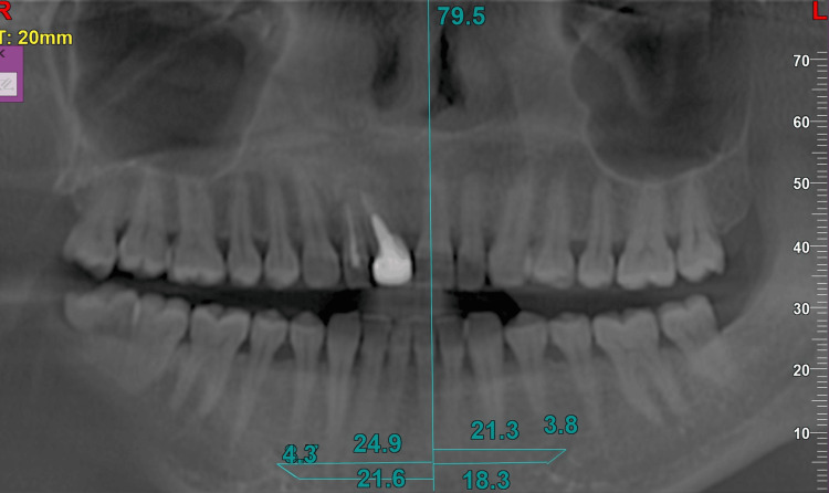 Figure 9