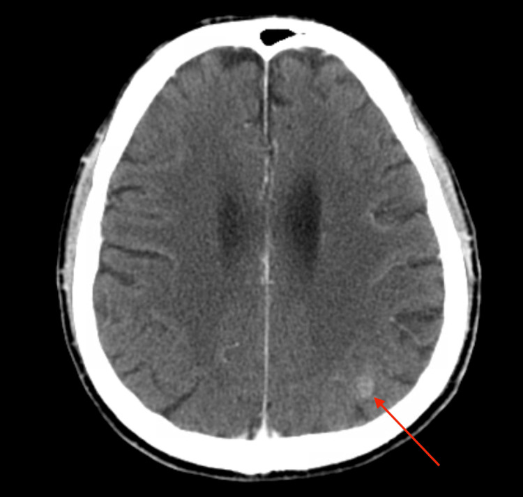 Figure 5