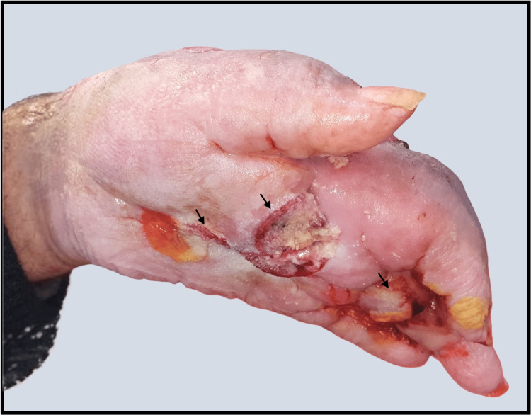 Figure 5