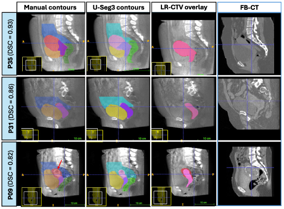 Figure 12