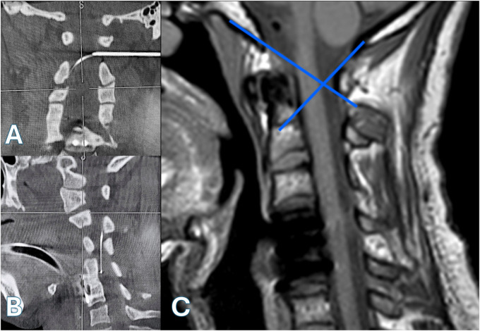 Figure 2