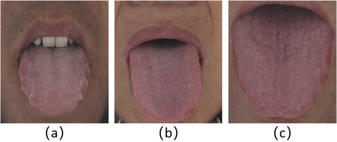 FIGURE 1