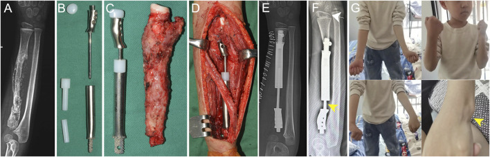 FIGURE 6