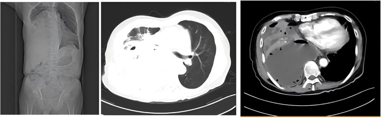 Figure 5