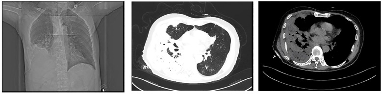 Figure 9