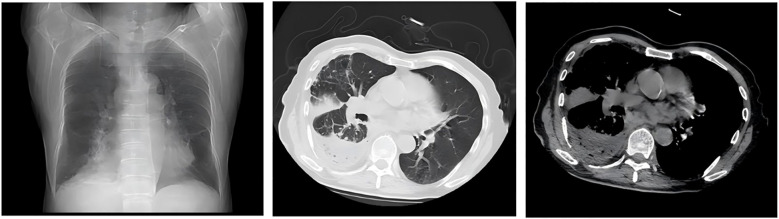 Figure 10
