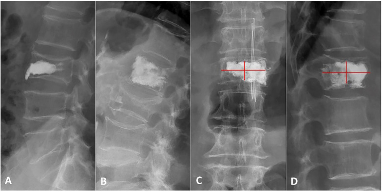 Figure 2