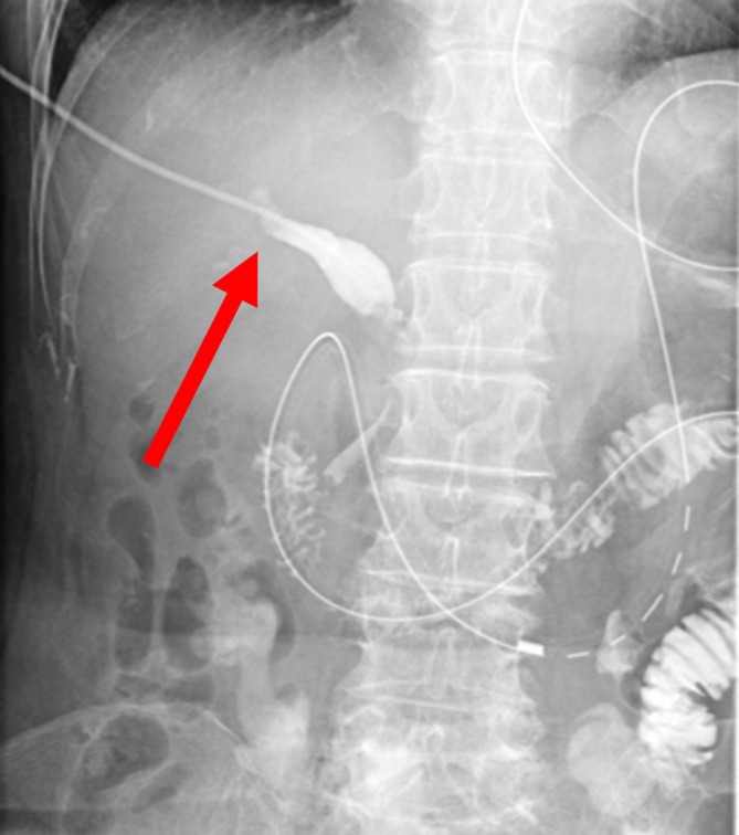 FIGURE 3
