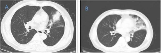 FIGURE 3