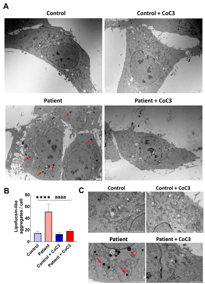 Figure 14