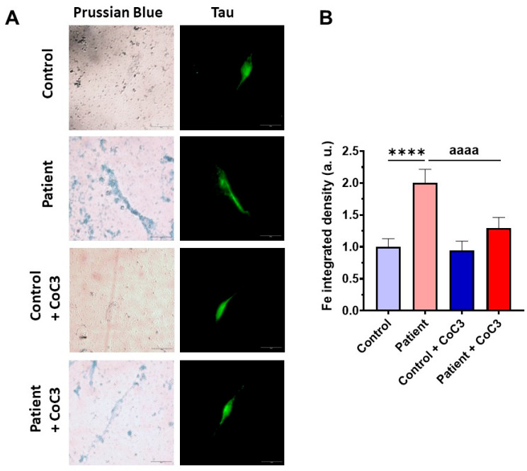 Figure 21