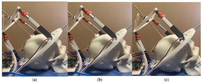 Figure 11