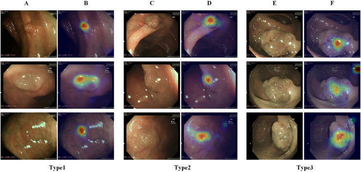 Figure 13