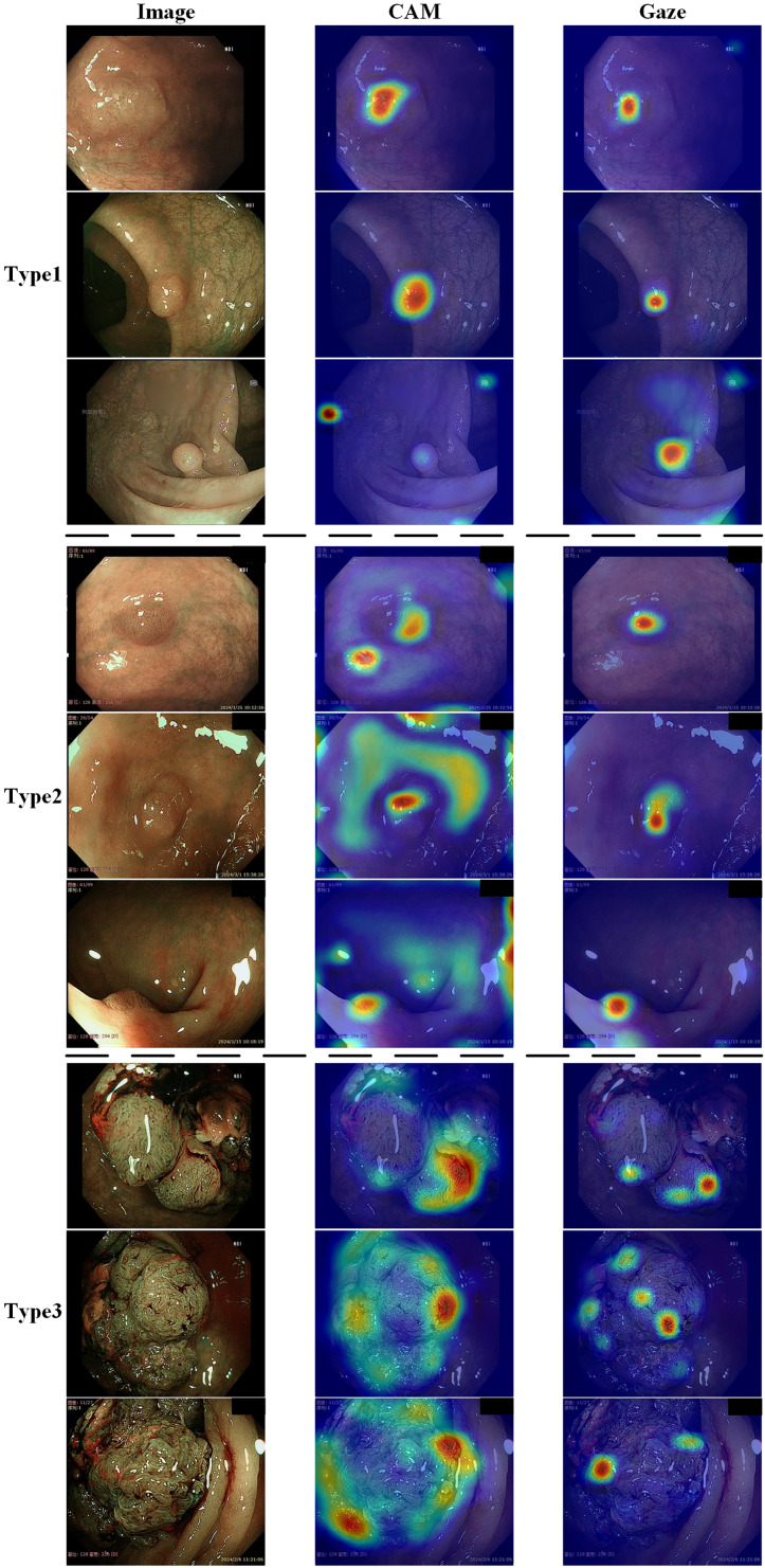 Figure 18