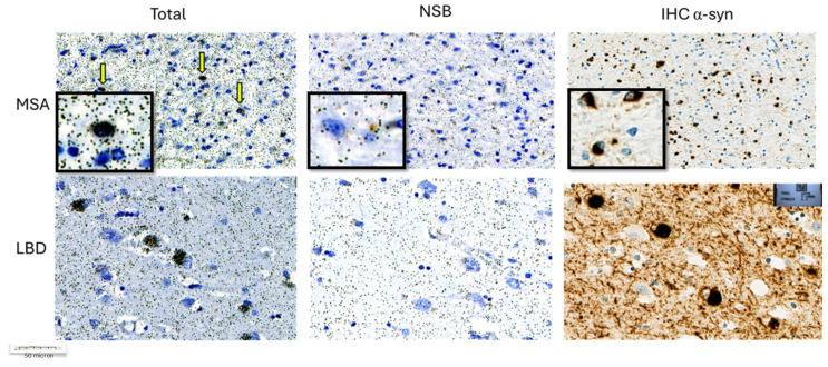 Figure 16