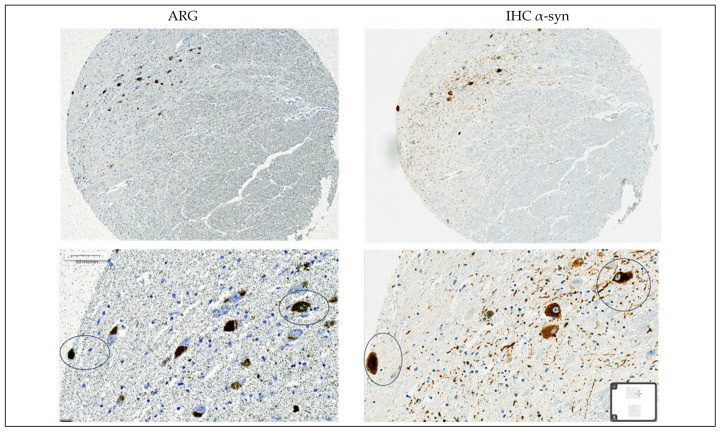 Figure 17