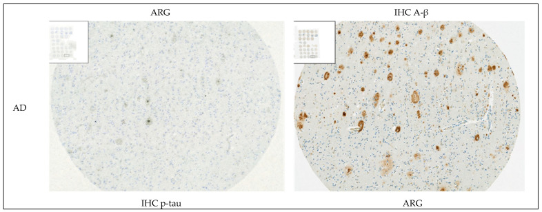 Figure 18