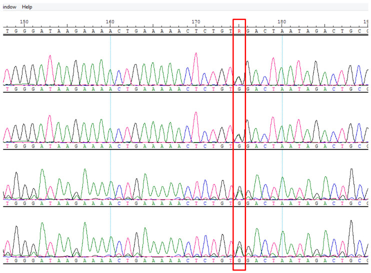 Figure 11