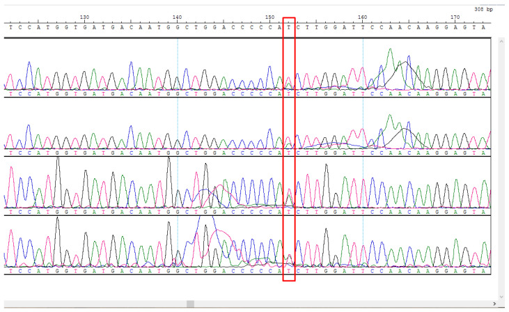 Figure 14