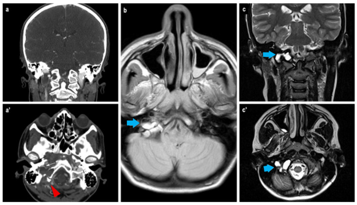Figure 2