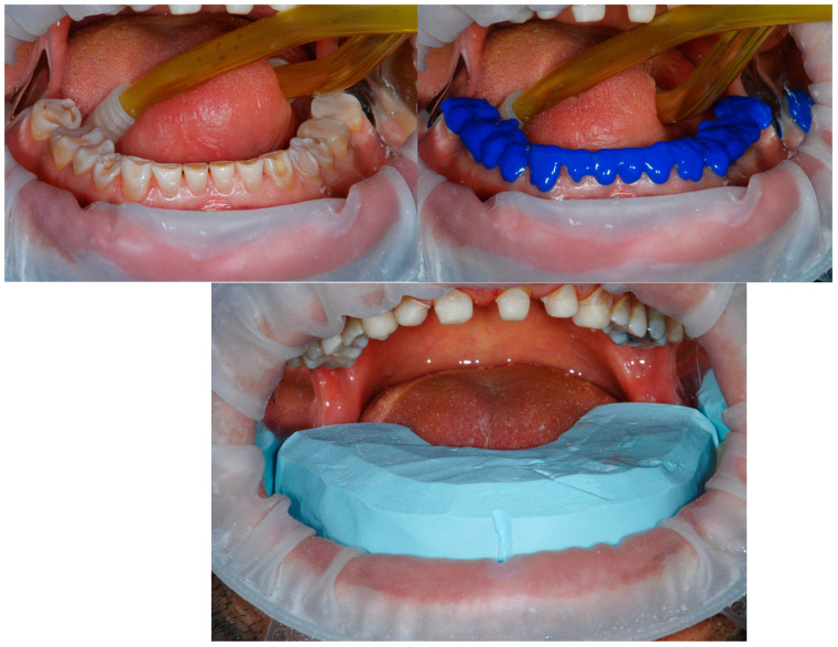 Figure 11