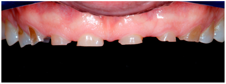 Figure 14