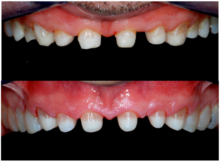Figure 15